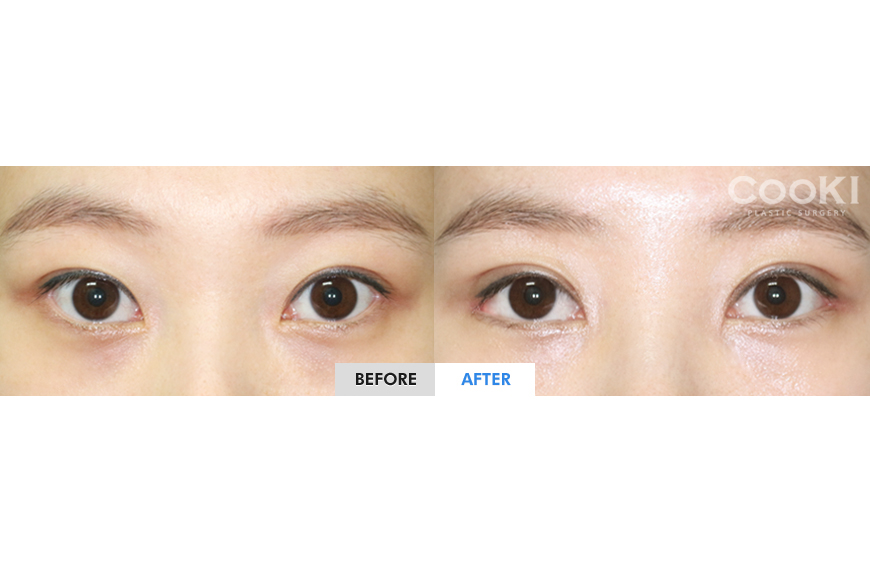 ビフォーアフター リアルストーリー ビフォーアフター写真