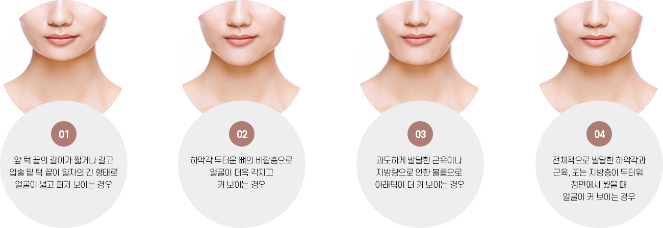 쿠키성형외과